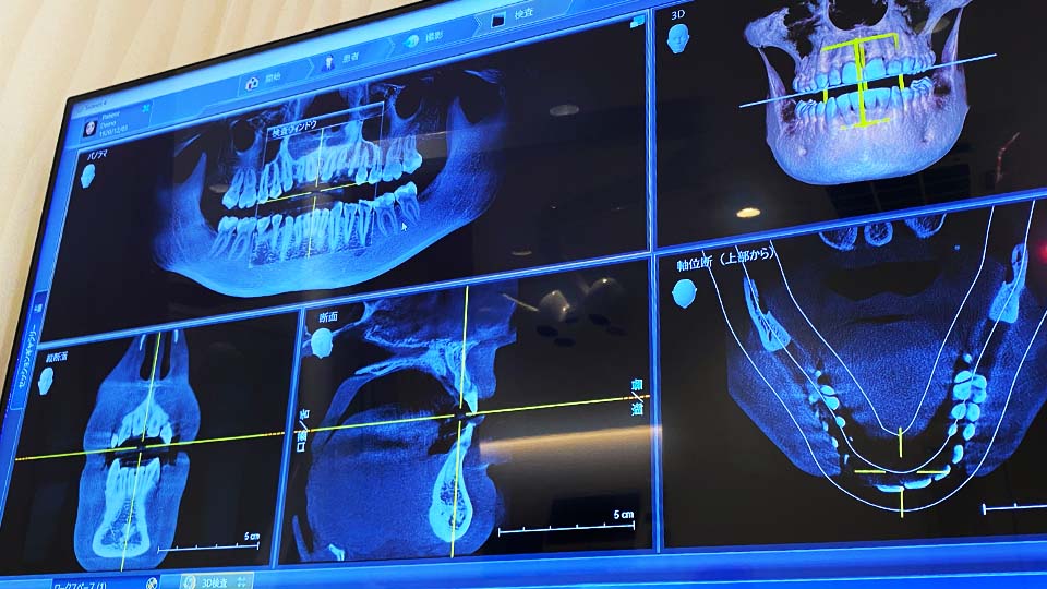 歯科用CT